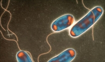 Março 2017 - Algumas chefias da Adubos de Portugal acusados no surto de legionella Março 2017 - Algumas chefias da Adubos de Portugal acusados no surto de legionella