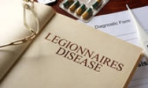 Novembro 2016 - Autoridades encerram hotel de Faro devido a legionella Novembro 2016 - Autoridades encerram hotel de Faro devido a legionella